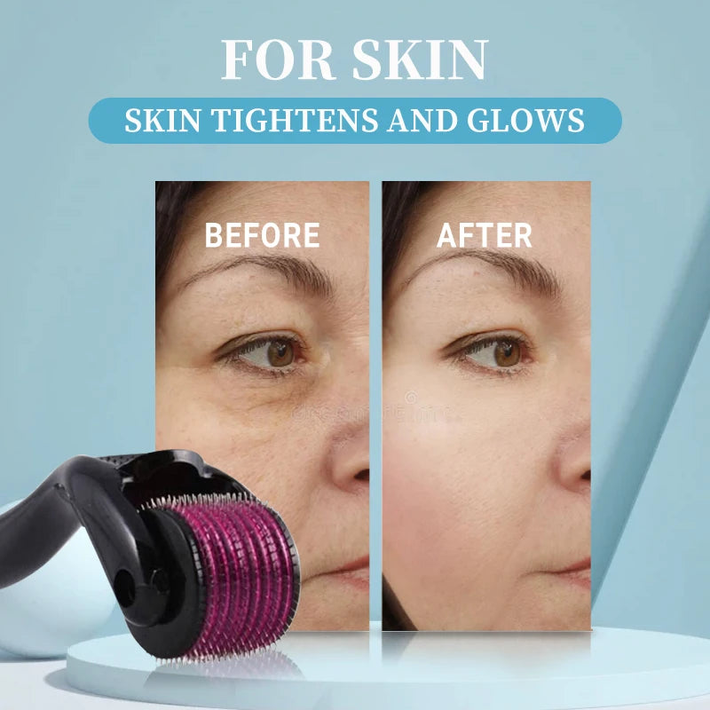 Titanium 540 Micro-Needling Derma Roller